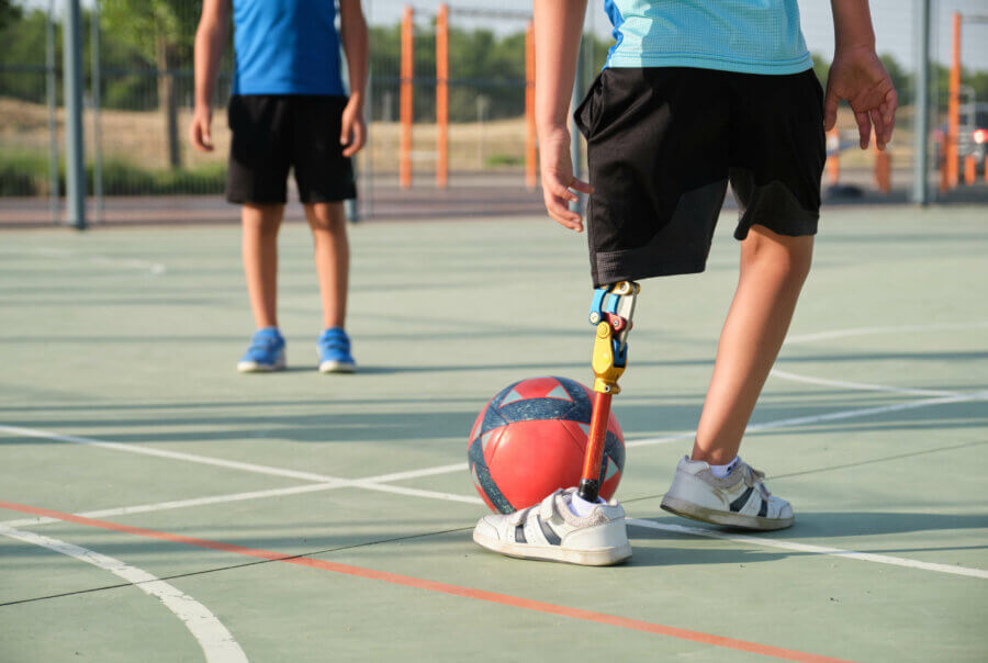 Eine Person mit Beinprothese spielt Fußball